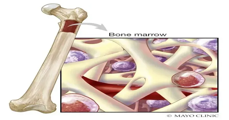 Just diagnosed: bone marrow and anemia