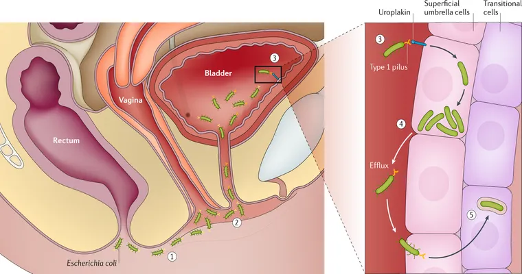 Home Remedies for Treating and Preventing Elderly UTI
