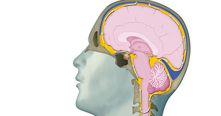 Normal Pressure Hydrocephalus vs. Dementia.