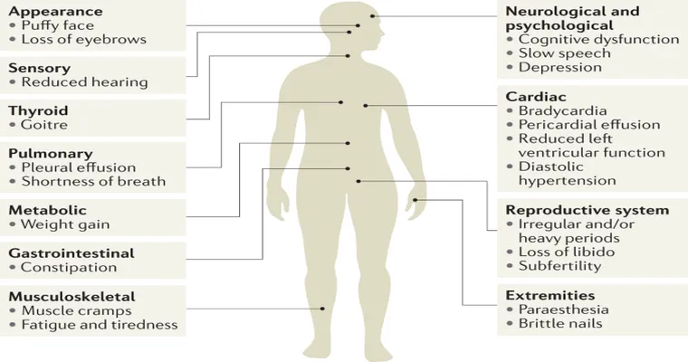 Left Untreated, Low Thyroid Can Be Life-Threatening