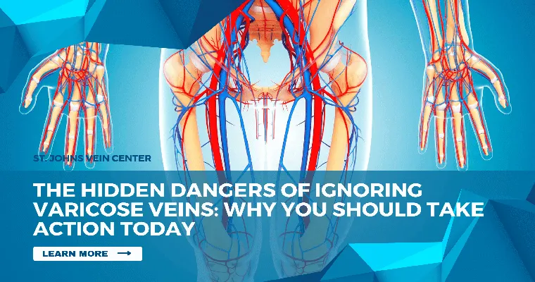 The Hidden Danger of Varicose Veins